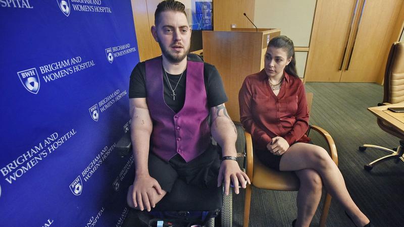 Retired Marine Sergeant John Peck speaks about his double arm transplant with his fiancée, Jessica Paker, at Brigham and Women's Hospital in Boston. (AP)