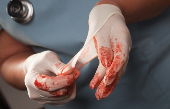 luvas manchadas de sangue